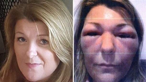 Botched 1 Jozette Sheppard