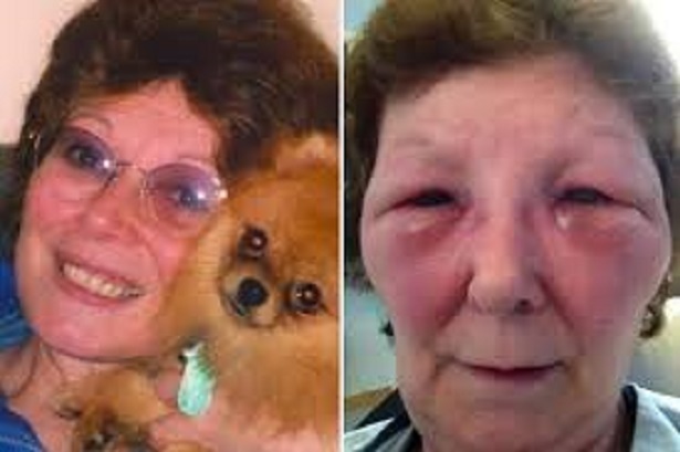 Botched Marcelle King larger